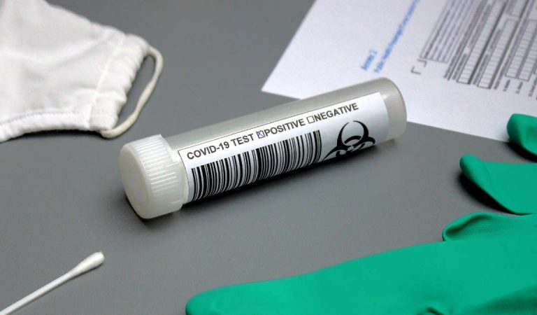Emergenza Covid in Piemonte: si parte subito con i test rapidi. Come e dove Emergenza Covid in Piemonte: si parte subito con i test rapidi. Come e dove